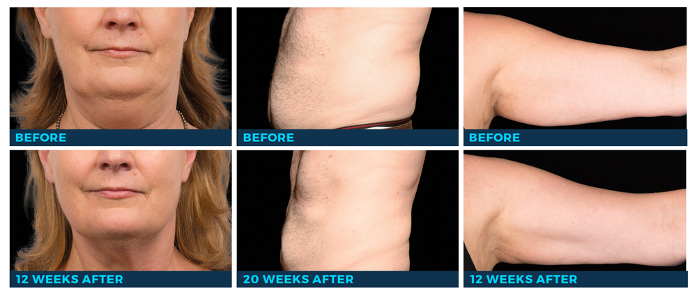 BeforeAfter2.jpg