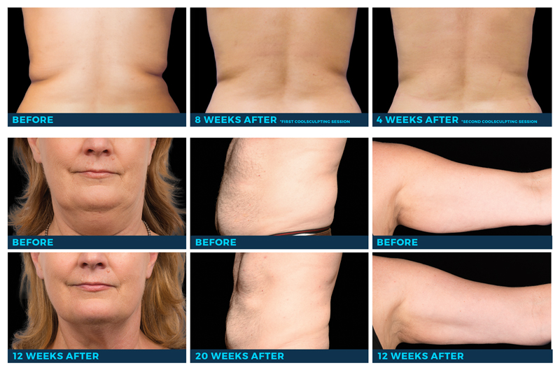 BeforeAfter3.jpg